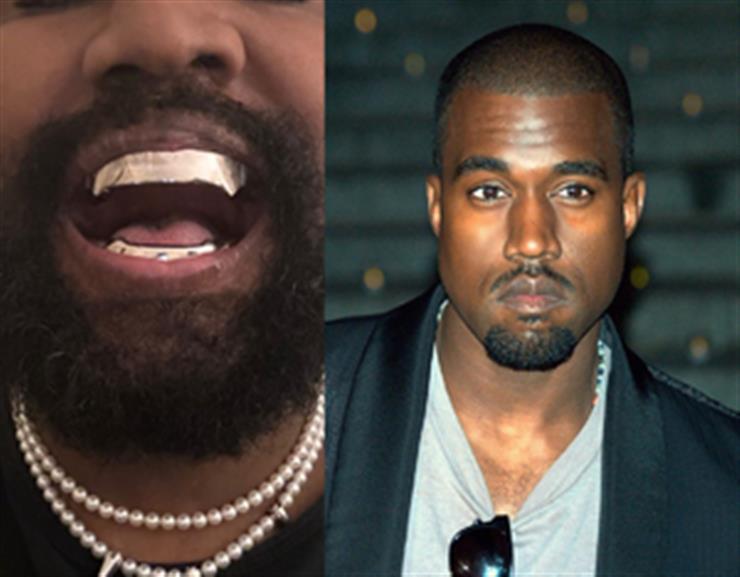 Kanye West replaces teeth with titanium gnashers