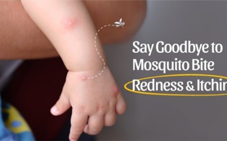 Handy Solution for Mosquito Bites: Parents’ Quick Fix Guide