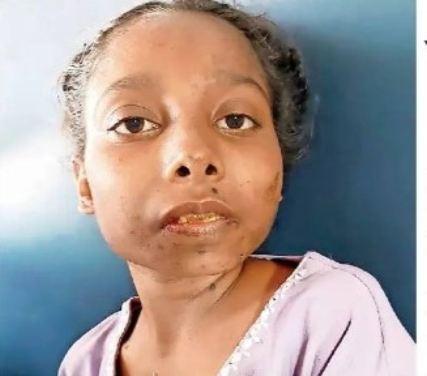 Minor Girl with Fractured Leg Found Abandoned Near Canal; Identity Still Unknown