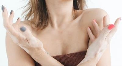 1 in 5 in England will contract skin cancer during their lifetime: Report