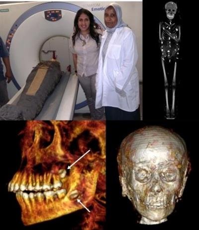 Egyptian researchers find amulets inside 2,300-year-old mummy via 'digital unwrapping'