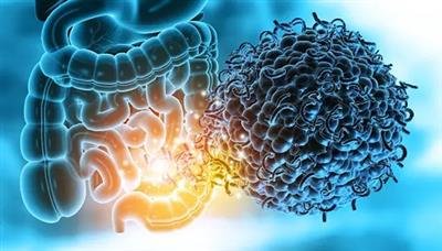 Study shows our gut microbes may determine bone health