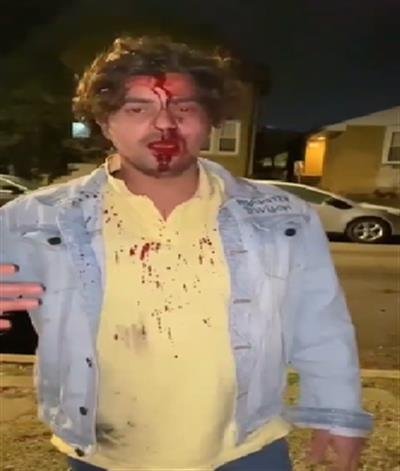 Indian student from Hyderabad in Chicago injured in attack by robbers