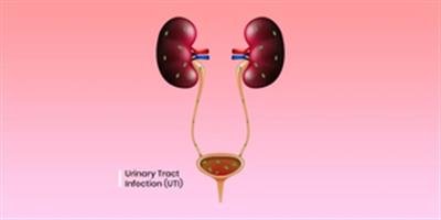 Study shows how E. coli causes urinary tract infections