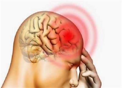 New technique identifies pathological abnormalities in motor neurone disease