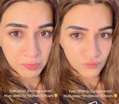 Kriti Sanon shares pictures of eyes post crying scene, needs 10 hours of sleep