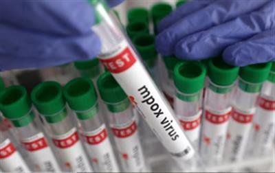 Mpox Clade 1b more infectious, increases risk of miscarriage: Study