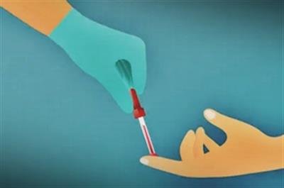 New blood test offers hope for early detection of Parkinson's disease