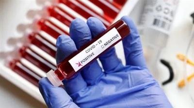 K'taka Health Ministry issues advisory, says sharp rise in Covid cases in Bengaluru in 20 days