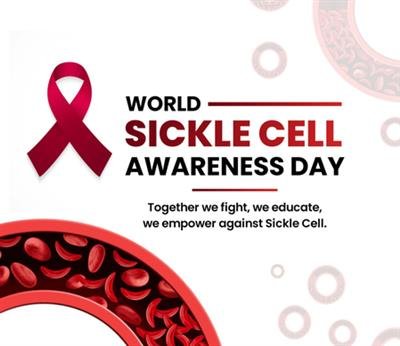 5.72 crore people screened for Sickle Cell Disease: Centre