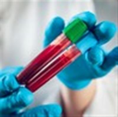 Deadly blood cancer can now be detected early with blood test: Study