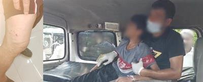 TN issues advisory on Rabies prevention after dog bite deaths in Kerala