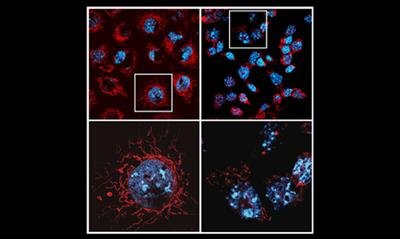 Study decodes why promising cancer treatments trigger serious side effects