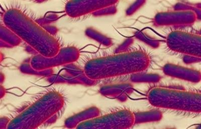One dead, six hospitalized amid outbreak of Legionnaires' disease in inner-Sydney