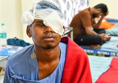 190 suffer firecracker, carbide gun-based eye injuries during Diwali: AIIMS Delhi