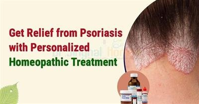 Managing Your Skin Naturally: Effective Homeopathic Treatment of Psoriasis